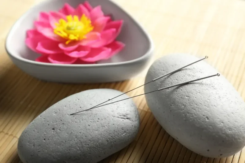 Using disposable and sterile needles, acupuncture can help relieve stress and anxiety.