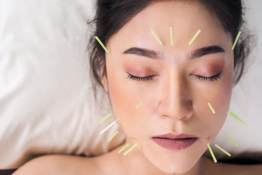 Acupuncture is a non-invasive treatment method for anxiety and depression.