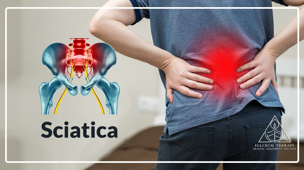 Sciatica is very common pain which may cause due to disk herniations or several other reasons.