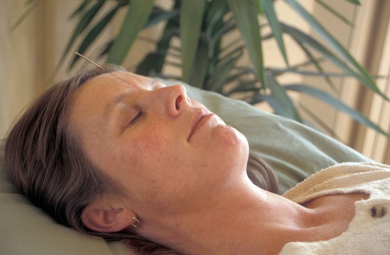 Acupuncture for Headaches